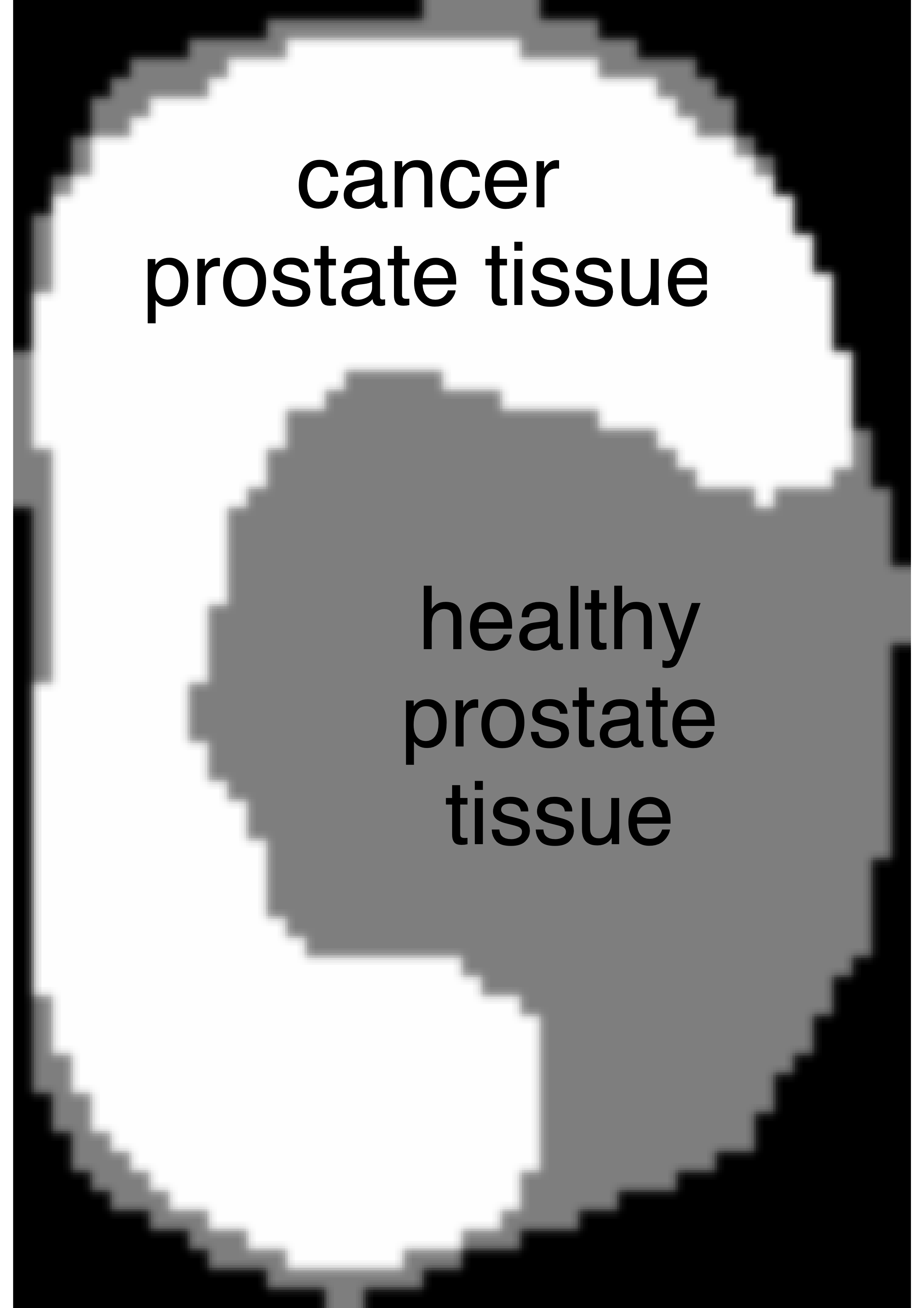 example slice of prostate scan